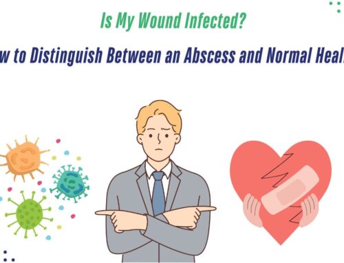 Is My Wound Infected? How to Distinguish Between an Abscess and Normal Healing – 2025