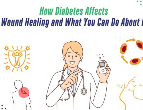 How Diabetes Affects Wound Healing and What You Can Do About It – 2025